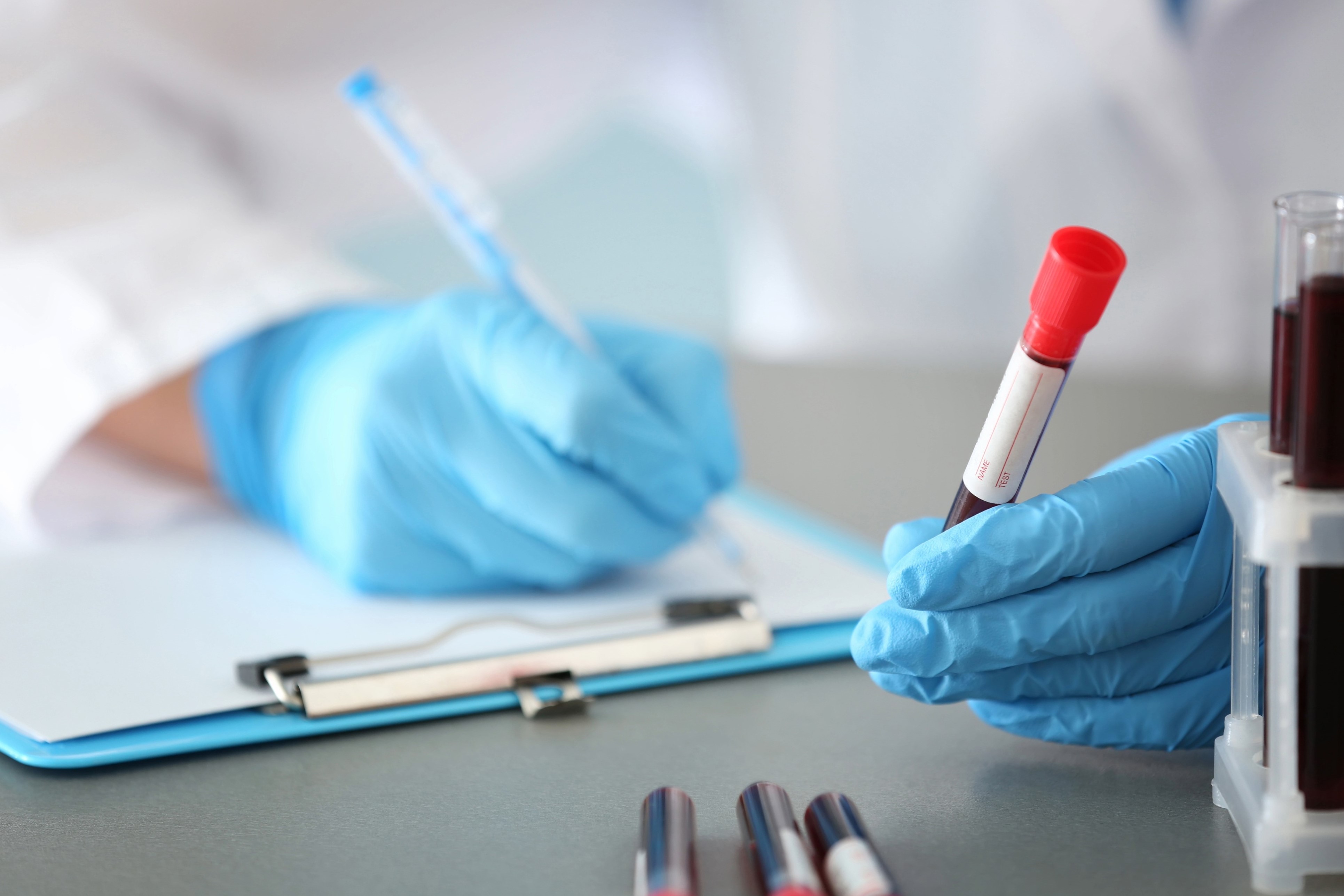 Immagine decorativa raffigurante un/a laboratorista che regge una provetta e scrive delle annotazioni.