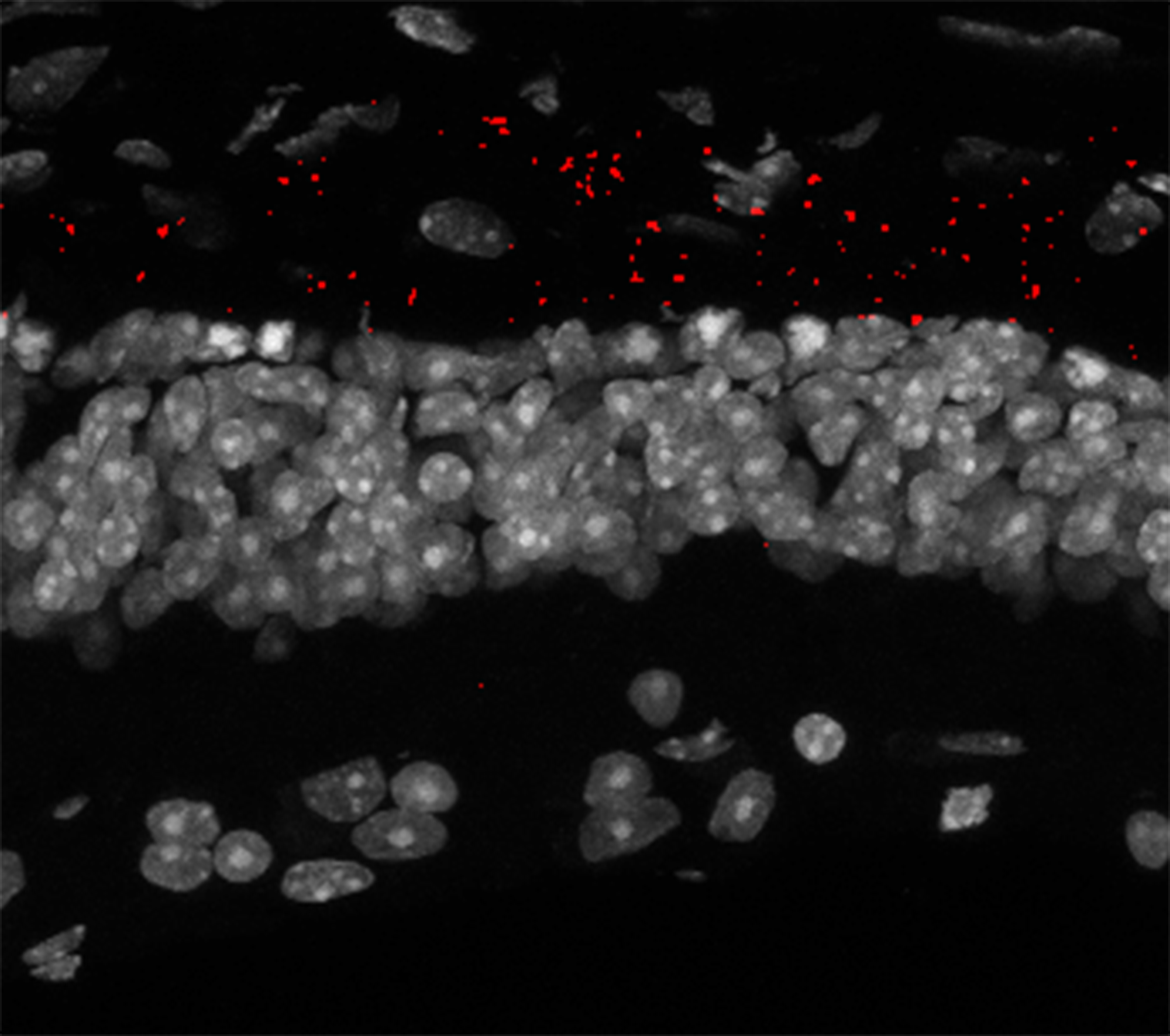 Ingrandimento a microscopio a fluorescenza di sezione trasversale di retina di un modello preclinico di retinite pigmentosa. In rosso, al posto dei fotorecettori, le nanoparticelle arricchite di ossido di grafene